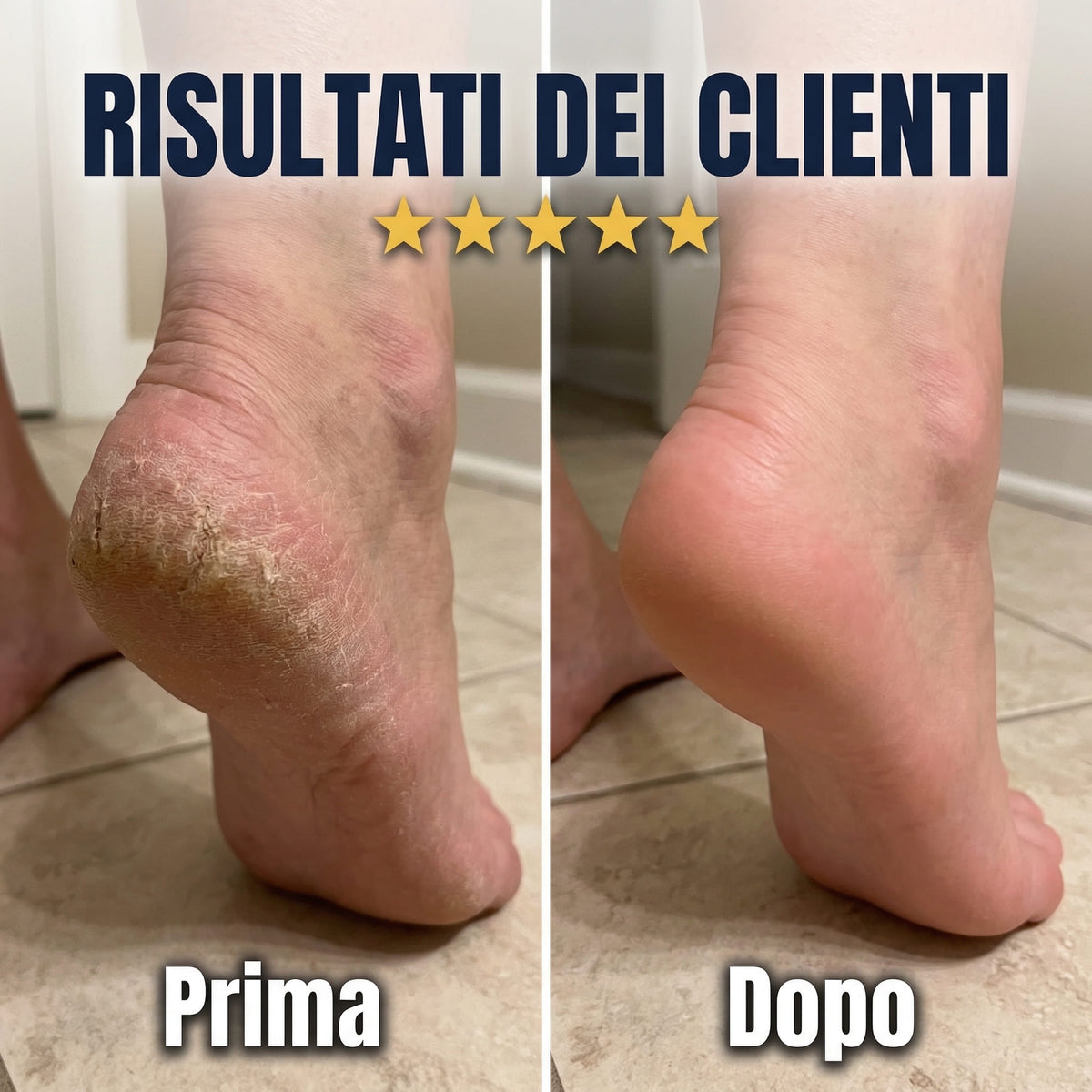 PediEase V2™ - Ritrova piedi morbidi come nuovi in 5 minuti