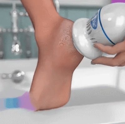 PediEase V2™ - Ritrova piedi morbidi come nuovi in 5 minuti